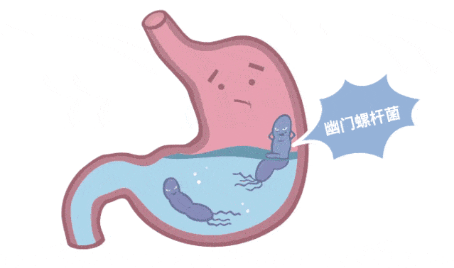 幽门螺杆菌生