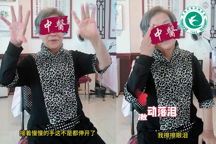 脑梗1年2个月后在我院进行康复治疗