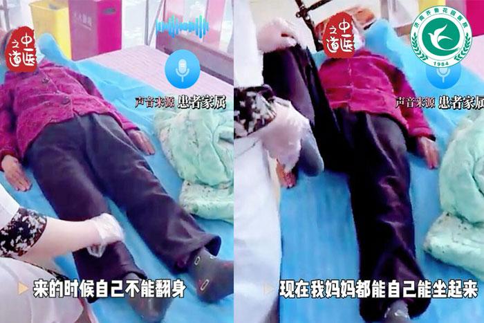 八旬奶奶患脑梗四天治疗进步大