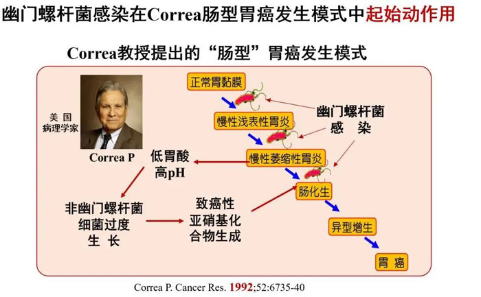 公认的Correa教授提出的“肠型”胃癌发生模式
