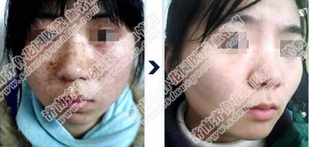 ϵĺɫߵȸ߻ǻƺְߣȸƤںϸ쳣Ƥ׷պͱȸõİ취ùȽĵQ755豸ۺơ