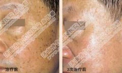 ���������ʲô�����Ƚϱ���