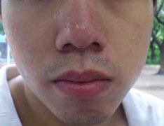 ��ҽ���ƾ�����Ϊʲô���缤���