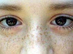 ����ȸ�ߴ�Ŷ���Ǯ