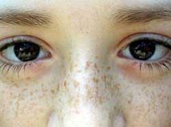 ����ȸ�ߴ�Ŷ���Ǯ����Q��������ȸ�����ֺ�ɫ���༲����Ч���Ƿǳ��õģ���������������Ƥ����֯��ֻ�Բ�����λ�������ã�����ȸ�߲��õ�Q��������ҩ���ۺ�����ȸ������õ�ѡ��