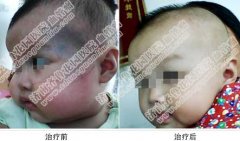 ̫���������εúò�����