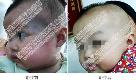 ̫���������εúã�̫����һ��Ӱ�캢�ӵ���ò�����ǶԺ��ӵ���������˺���˫����Ⱦ�ϼ��⹤��վ������Ժ�����Ƚ�����Эͬ����̫���룬�������Ƹ����ף�����ȫ�����˷��������ȱ׶ˡ�