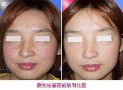 ��û�п���ȥ��ȸ�߲������ķ���