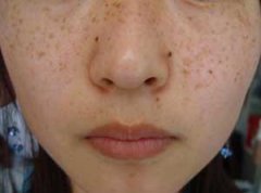 ���ϳ��ֺö��ɫȸ��Ӧ����ô��