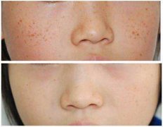 ������ȸ�ߵ�Ч���ò���