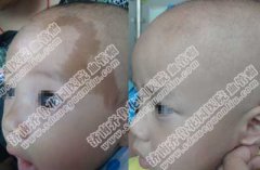 ������Ȱ߻᲻�ᵱʱ��Ч��֮���ָ���