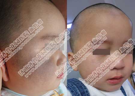 ������ƽ������̫����õ�ҽԺ���ļң�����ѡ�������³��԰ҽԺ����Q���������������ƺ�̥��̫������õ������豸���������������з����޸����ۺ����ƣ��ָܻ�����ƽ������״̬��