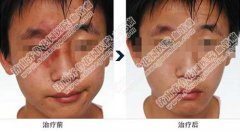 �۽�̥����ɫ������ȥ�Ͳ���ɽ���������ƱȽϺ�