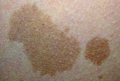 ��Ȱ���Ҫ����Ǯ