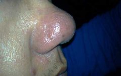 ѹ��̫����ڽ������׻��Ͼ������