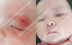 �������ϳ����ĺ�̥�����κ���