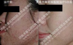 Ϊʲô���Ӷ����������