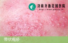 ������ҹ�Ӱ����׻���״����