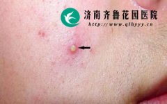 ʲô�����沿�ܻ�����Ӧ����δ���