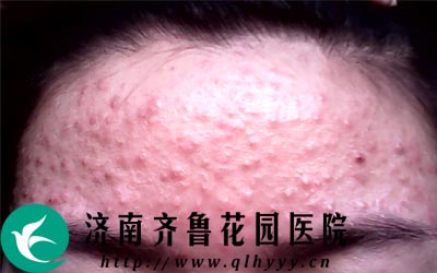 ë���׺÷���ͷ���沿��֫�Ȳ�λ�����ɻ�ŧ������ַ�ë�ҿ���Χ�����µġ�