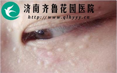 ������һ�������������澱�Ȳ�λ���÷���Ů�ԣ�������ƣ�ͻ��ߵֿ����½�ʱ�������ͻ�Խ��Խ�ࡣ