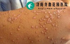 ��ƽ����ʲôΣ�������ļ�ҽԺ���ƺ�