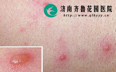 ��ֳ�������Σ���ܴ����ᵼ�²��в����������ֲ���֢������һ��Ҫ��ʱ���ơ�