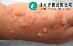 ��ƽ����кܴ�Ĵ�Ⱦ����ô���ƺõĿ�