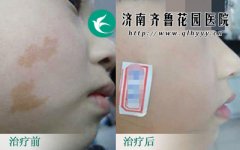 �����ļ�ҽԺ�������ƿ��Ȱ�Ч�����