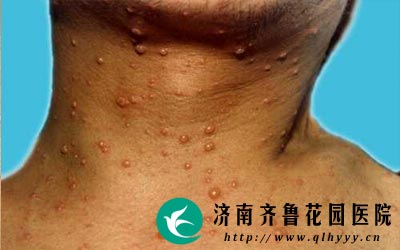 ���ƴ�״������Ҫ����Ǯ��Ҫ�����Ĳ������������ѡ������Ʒ�����