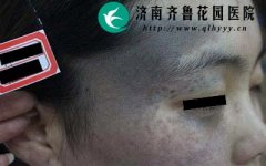 ɽ��ʡ�������ļ�ҽԺ����̫�����