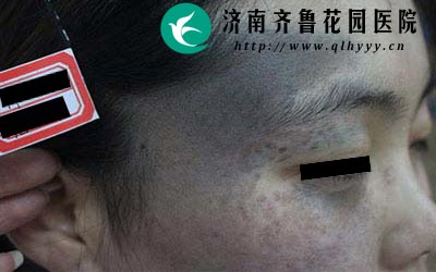 ����̫����һ��Ҫѡ��רҵ��ҽԺ�����ƣ��������Ʋ����������°̺��������ݡ�