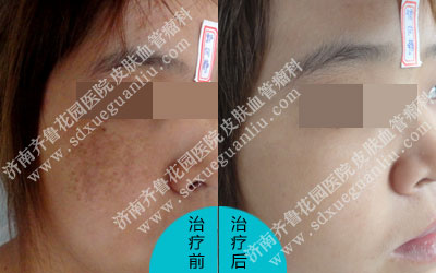 �������������ȧ������ͷ����򨲿������������Ƥ����ɫΪ�ں�ɫ�����ɫ��Һ�ɫ�İ������Ůʿȧ�Ǵ����˺������Ѻü����ˣ���������Ժ��ѯ���������ȥ������