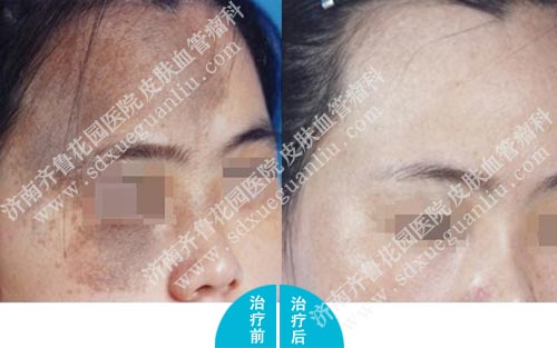 ��������̫������Ҫע��ʲô