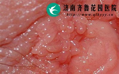 ����ʪ����Ҫ����������ͷ��������Ⱦ���á�