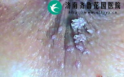 ���Լ���ʪ�໹�ᷢ���ڸ��ܲ�λ��