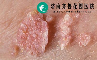 ����ʪ�����Ʋ����׻Ḵ����