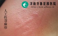 Ƥ������һ�����к�ۼ�������ݡ����