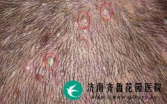 ������ë����Σ������Щ