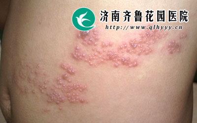 �ڴ��＾�����Ǿ��������ܶ��״����ߣ������ǳ�����ռ���������ô����״�����������ʲô�أ���״�����Σ��������Щ�ء�