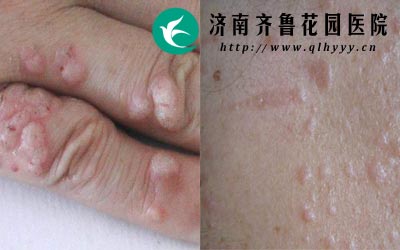 ��ƽ����һ�ֲ�����Ƥ��������������