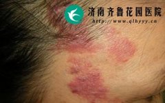 ��״����ᴫȾ����������