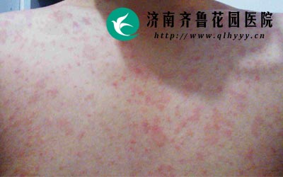 ʳ�ô̼��ԵĻ�ױƷ��ֱ������ݡ���