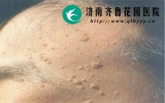 ��ƽ�໼��Ӧ�����������������