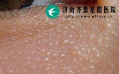 �������ĳ���֢״����Щ