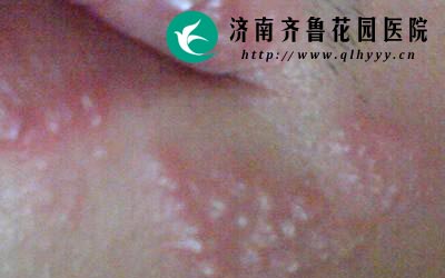 �촽����������Ҫ���ֻ�����ˬ��