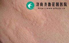 Ƥ��������������ݡ����