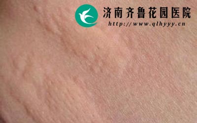 ݡ������Ƥ�����������µ���һ�����Ŵ����ء�