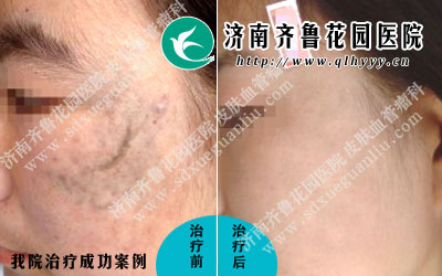 ̫����ķ�������Ӱ�컼�ߵ���������罻������˵���̫����������ǲ���С�ӵģ�Ŀǰ��˵����̫������õķ����ǲ��ü�������̫���ôЧ������ء�