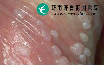 ���Լ���ʪ��÷�����ֳ���Ĺ�ͷ��Ƥ������ڵȴ���